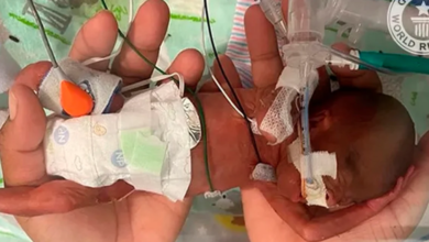 Bebê prematuro cabia na palma das duas mãos.